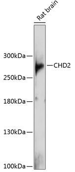 CHD2 Rabbit Polyclonal Antibody