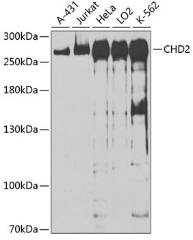 CHD2 Rabbit Polyclonal Antibody
