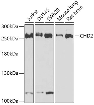 CHD2 Rabbit Polyclonal Antibody