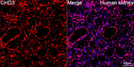 CHD3 Rabbit Monoclonal Antibody - Image 2