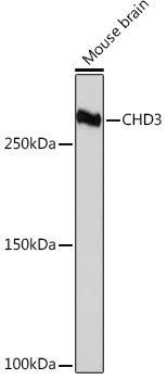 CHD3 Rabbit Monoclonal Antibody - Image 3