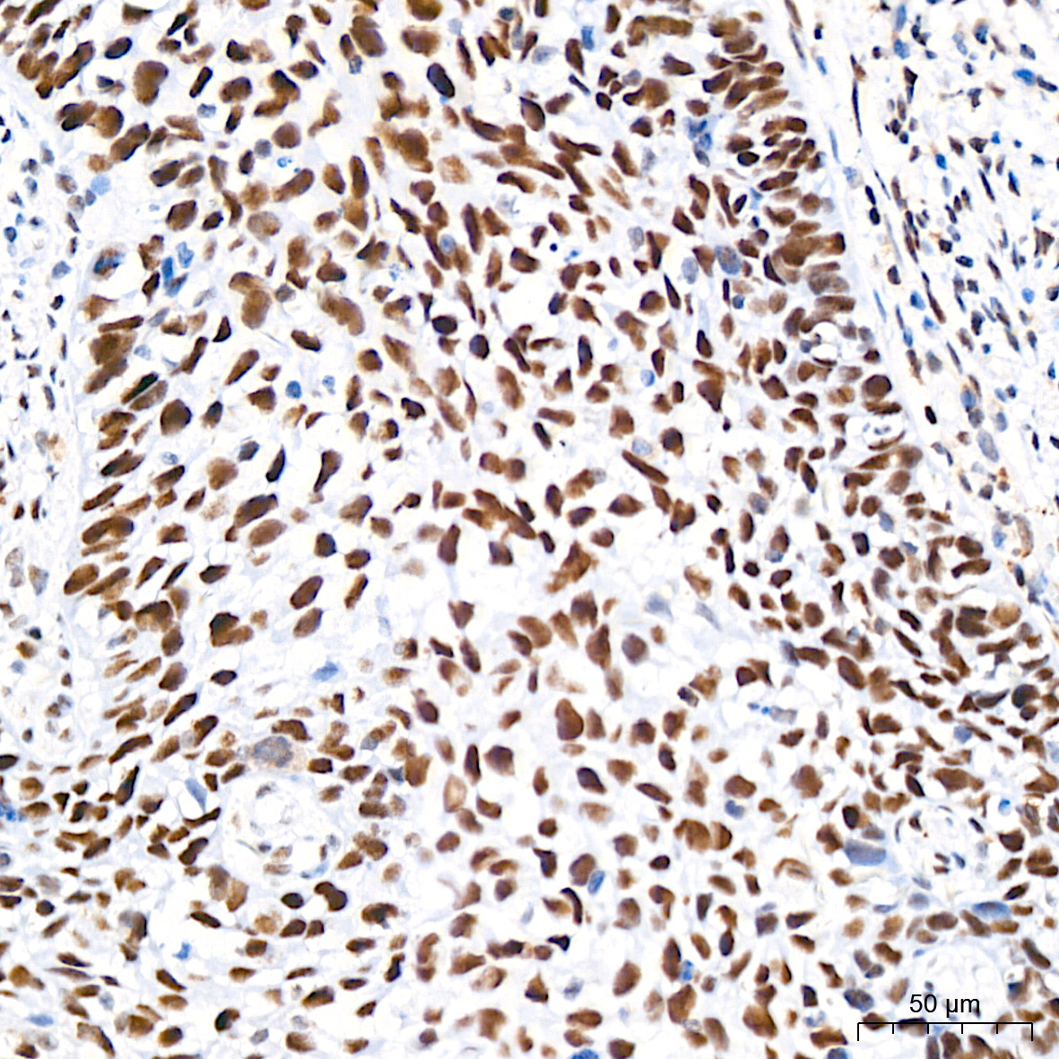 CHD3 Rabbit Monoclonal Antibody - Image 5