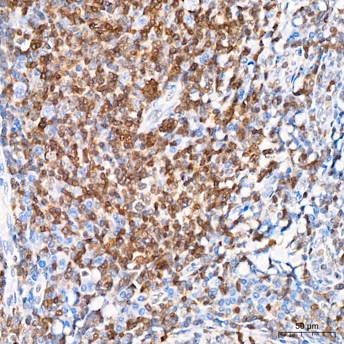 CHD3 Rabbit Monoclonal Antibody - Image 6