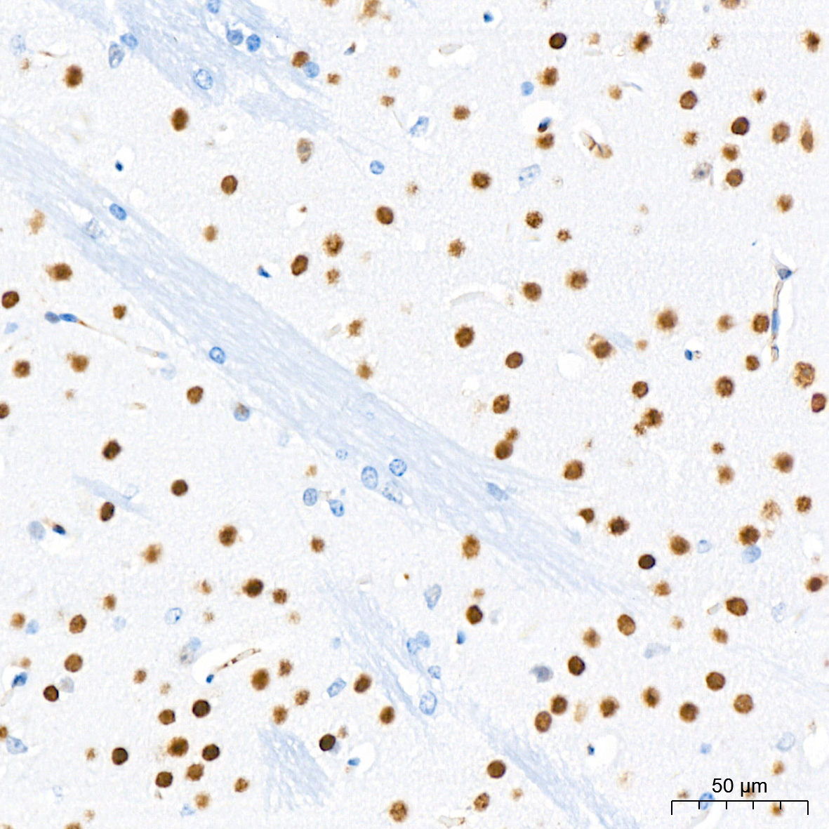 CHD3 Rabbit Monoclonal Antibody - Image 7