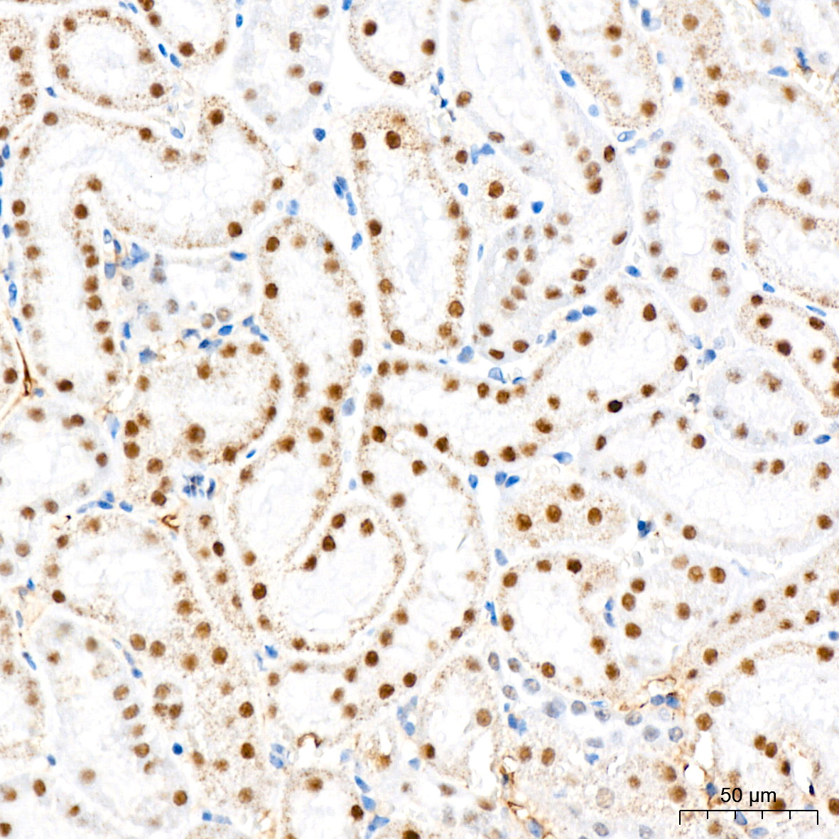 CHD3 Rabbit Monoclonal Antibody - Image 8