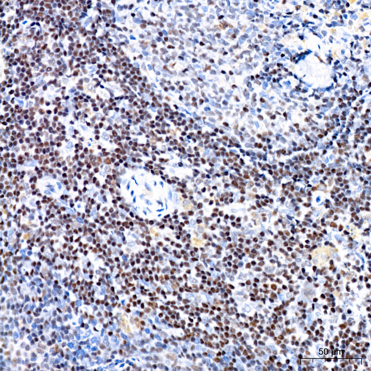 CHD3 Rabbit Monoclonal Antibody - Image 9