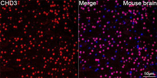 CHD3 Rabbit Monoclonal Antibody - Image 10