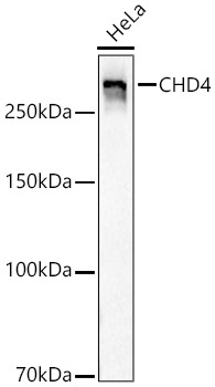 CHD4 Rabbit Monoclonal Antibody