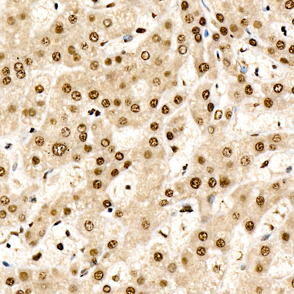 CHD4 Rabbit Monoclonal Antibody - Image 2