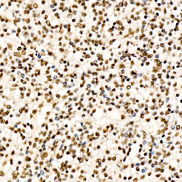 CHD4 Rabbit Monoclonal Antibody - Image 3