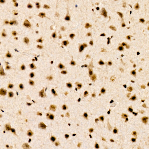 CHD4 Rabbit Monoclonal Antibody - Image 4