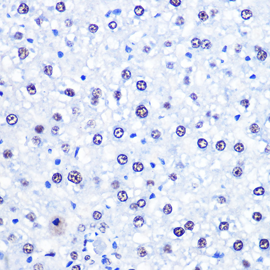 CHD4 Rabbit Polyclonal Antibody - Image 2