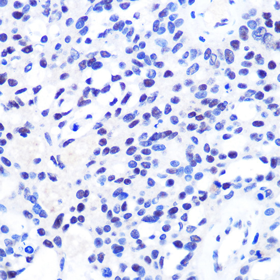 CHD4 Rabbit Polyclonal Antibody - Image 3