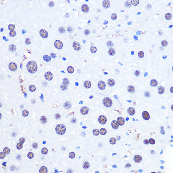 CHD4 Rabbit Polyclonal Antibody - Image 4