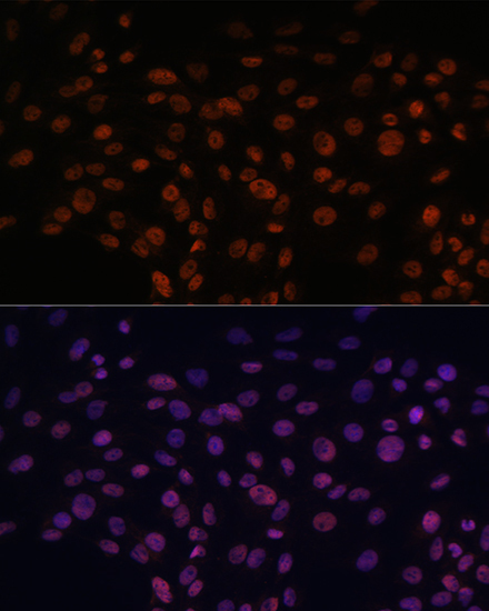 CHD4 Rabbit Polyclonal Antibody - Image 5