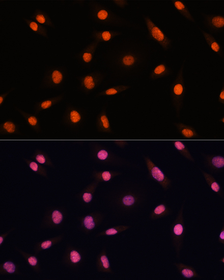 CHD4 Rabbit Polyclonal Antibody - Image 6