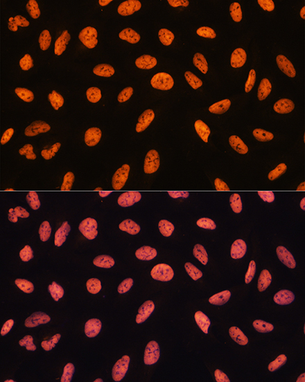 CHD4 Rabbit Polyclonal Antibody - Image 7