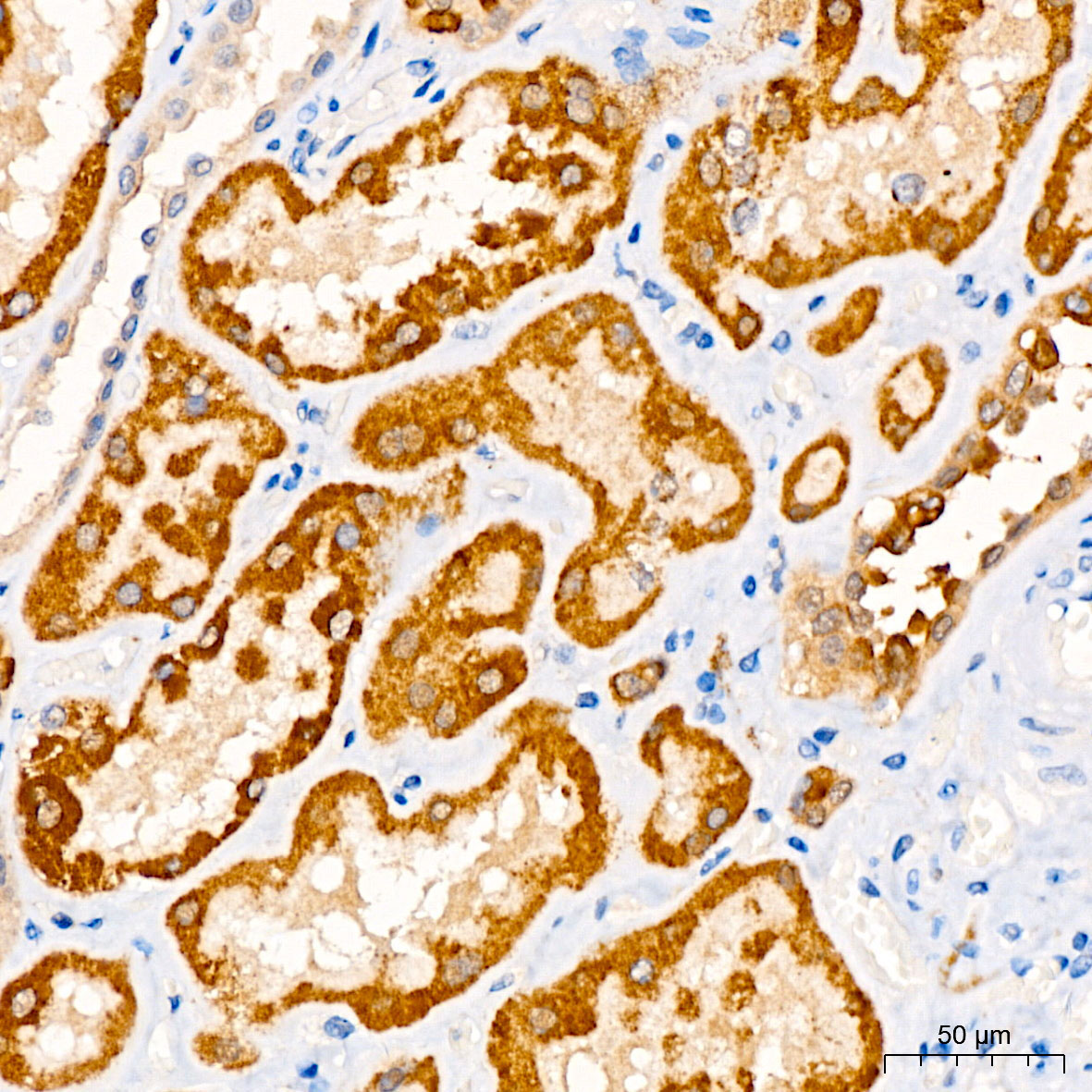 CHDH Rabbit Polyclonal Antibody - Image 2