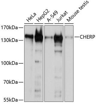 CHERP Rabbit Polyclonal Antibody