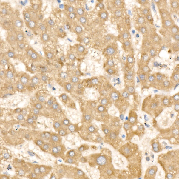 CHI3L2 Rabbit Polyclonal Antibody - Image 2