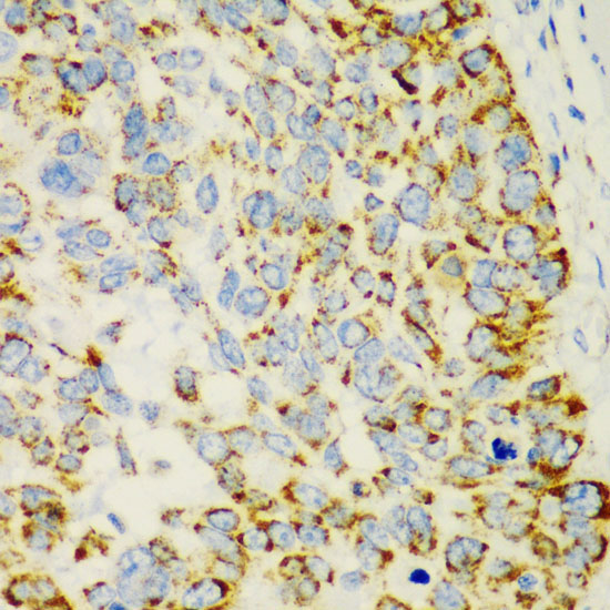 CHIA Rabbit Polyclonal Antibody - Image 2