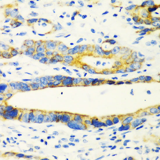 CHIA Rabbit Polyclonal Antibody - Image 3