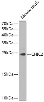 CHIC2 Rabbit Polyclonal Antibody