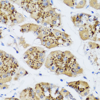 CHIC2 Rabbit Polyclonal Antibody - Image 2