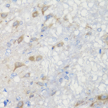 CHIC2 Rabbit Polyclonal Antibody - Image 3