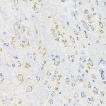 CHIC2 Rabbit Polyclonal Antibody - Image 4