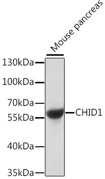 CHID1 Rabbit Polyclonal Antibody