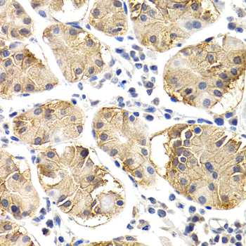 CHIT1 Rabbit Polyclonal Antibody - Image 2