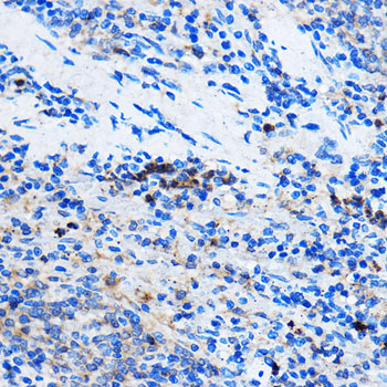 Chk1 Rabbit Polyclonal Antibody - Image 4