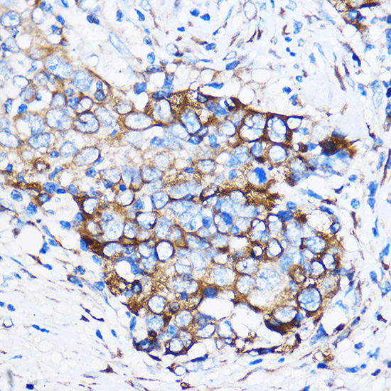 Chk1 Rabbit Polyclonal Antibody - Image 5