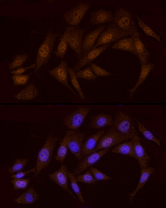 Chk1 Rabbit Polyclonal Antibody - Image 6