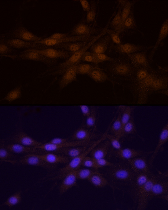 Chk1 Rabbit Polyclonal Antibody - Image 7
