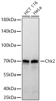 Chk2 Rabbit Monoclonal Antibody