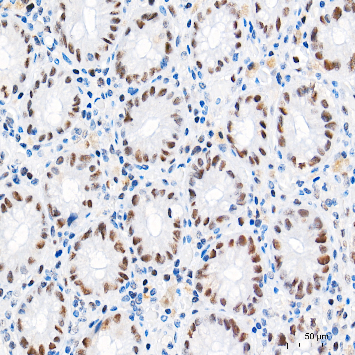 Chk2 Rabbit Monoclonal Antibody - Image 2