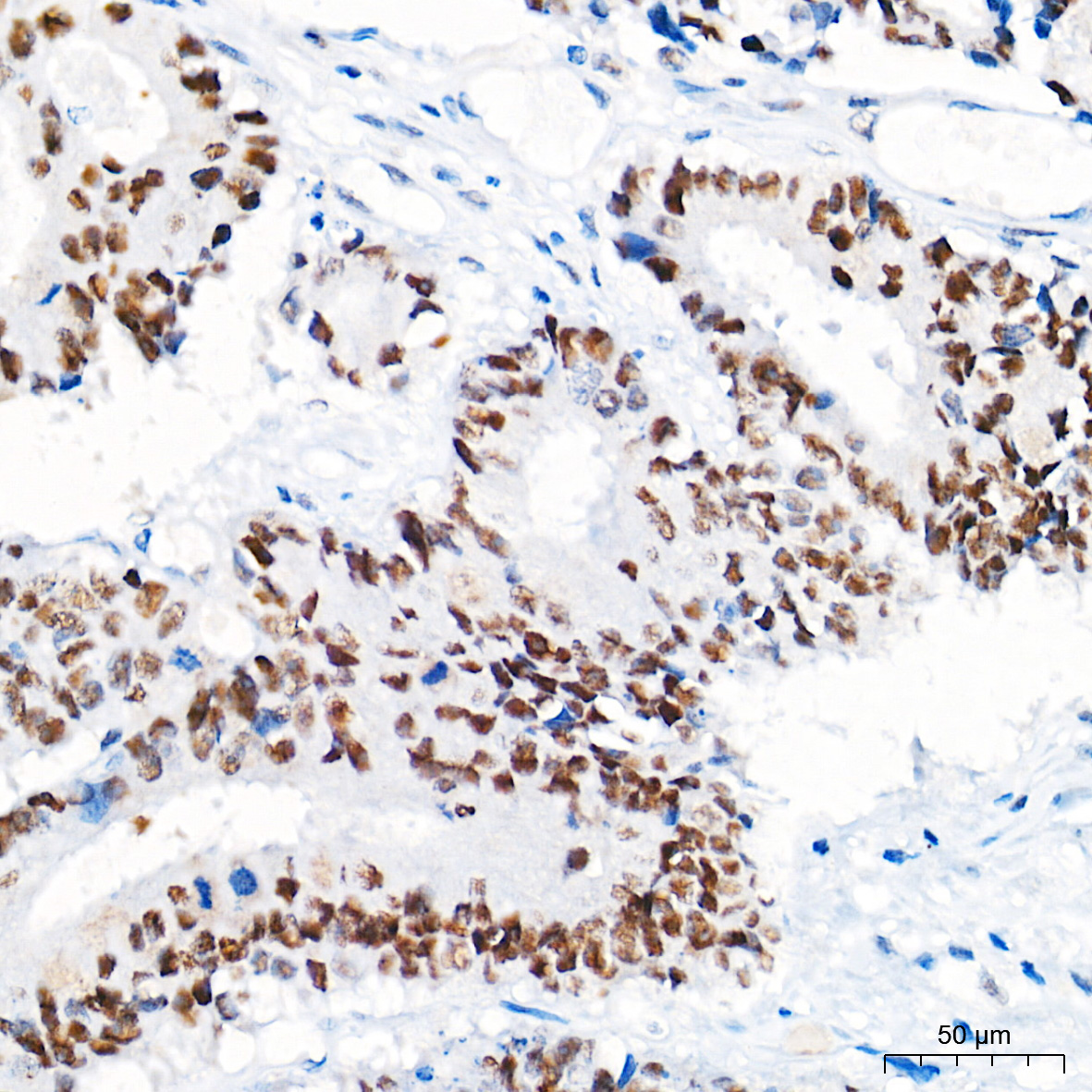 Chk2 Rabbit Monoclonal Antibody - Image 3