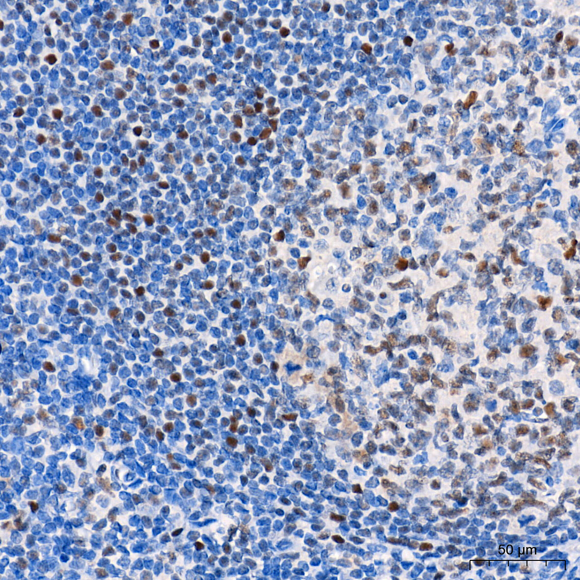 Chk2 Rabbit Monoclonal Antibody - Image 4