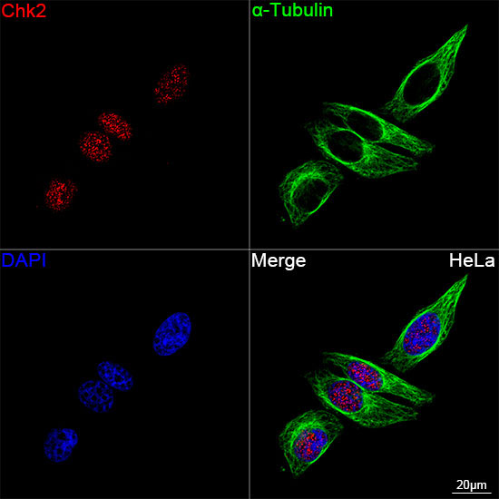 Chk2 Rabbit Monoclonal Antibody - Image 6