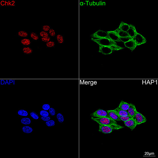 Chk2 Rabbit Monoclonal Antibody - Image 7