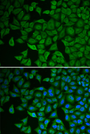 Chk2 Rabbit Polyclonal Antibody - Image 2