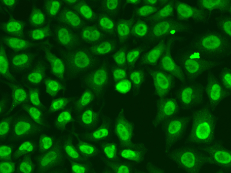 Chk2 Rabbit Polyclonal Antibody - Image 3