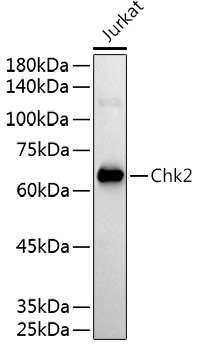 Chk2 Rabbit Polyclonal Antibody