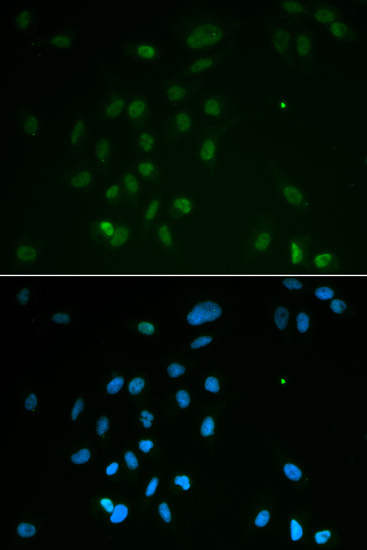 Chk2 Rabbit Polyclonal Antibody - Image 3