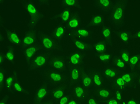Chk2 Rabbit Polyclonal Antibody - Image 4