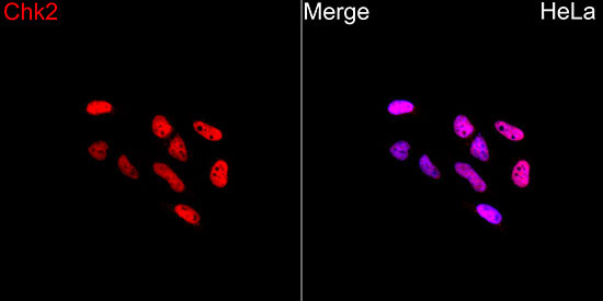 Chk2 Rabbit Polyclonal Antibody