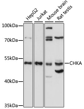 CHKA Rabbit Polyclonal Antibody