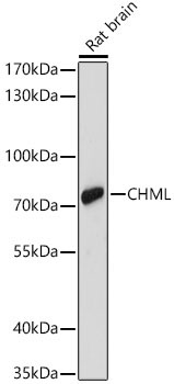 CHML Rabbit Polyclonal Antibody